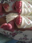 大龄公务员供卵试管筛选性别 好“孕”如期而至