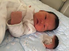 卵巢早衰张女士成功助孕