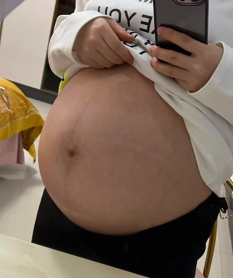 张雨绮产后复出大晒好身材